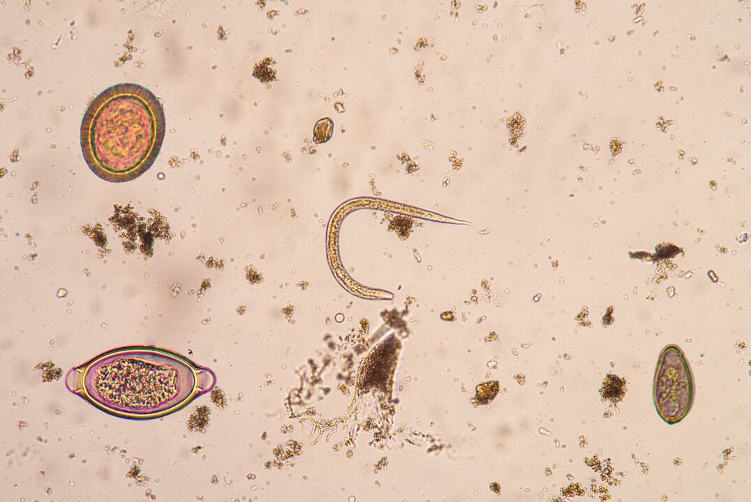 Stadium larwalne pasożytów podskórnych