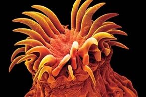 Pasożyty przywr u ludzi