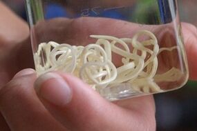 pasożyty z organizmu człowieka