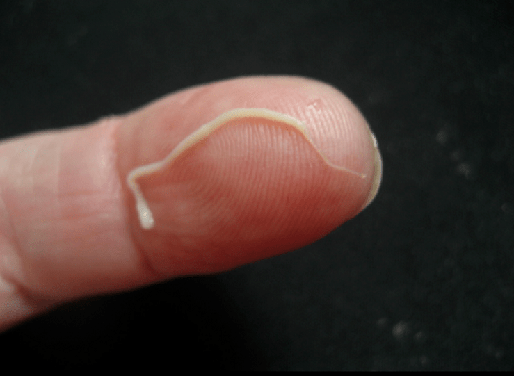 pasożyta glisty z organizmu ludzkiego